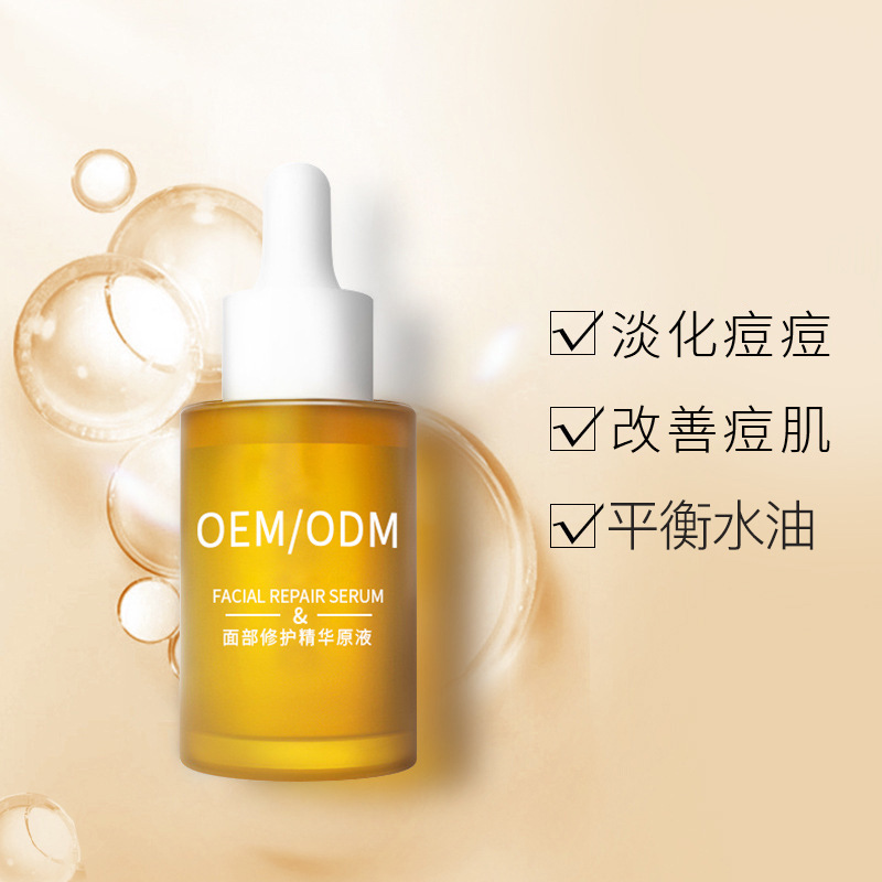 雅纯_祛痘精华原液OEM